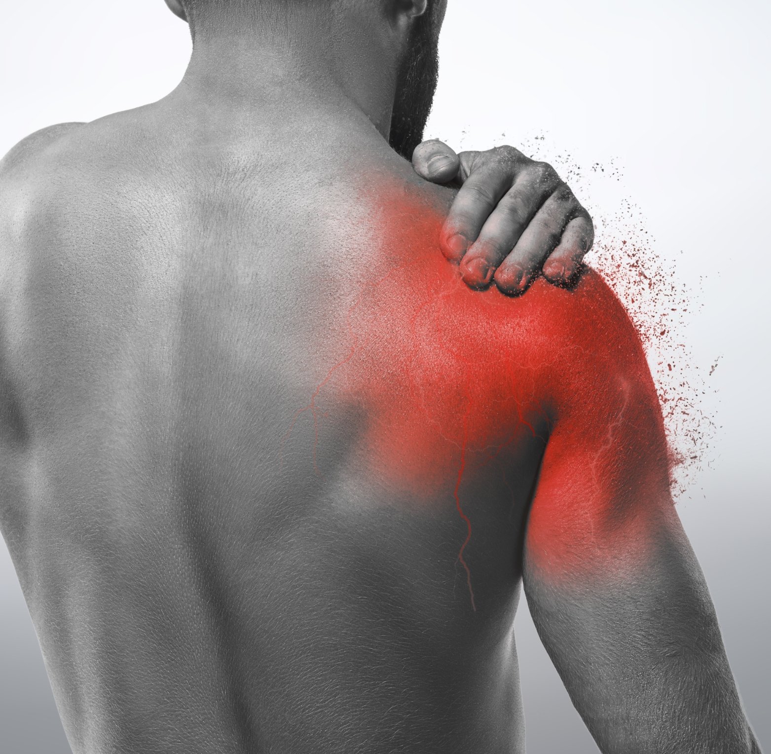 Frozen Shoulder 