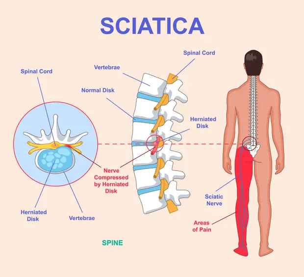 Chiropractor Balasaheb - Chiropractor in Mumbai