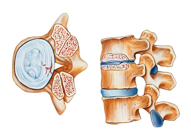 Chiropractor Balasaheb - Chiropractor in Mumbai